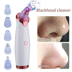 Super Suction Blackhead Remover