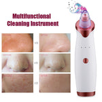 Super Suction Blackhead Remover