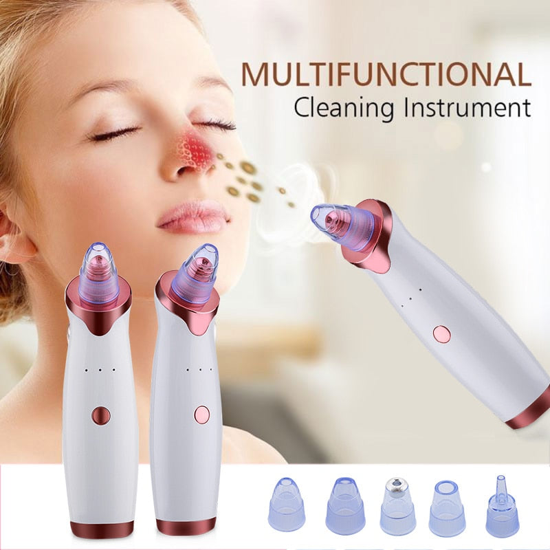 Super Suction Blackhead Remover