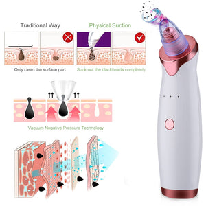 Super Suction Blackhead Remover